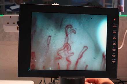 血液サラサラなPolly先生の画像。
細い毛細血管の隅々まで血液が行き渡っています
《クリックで大きな画像》